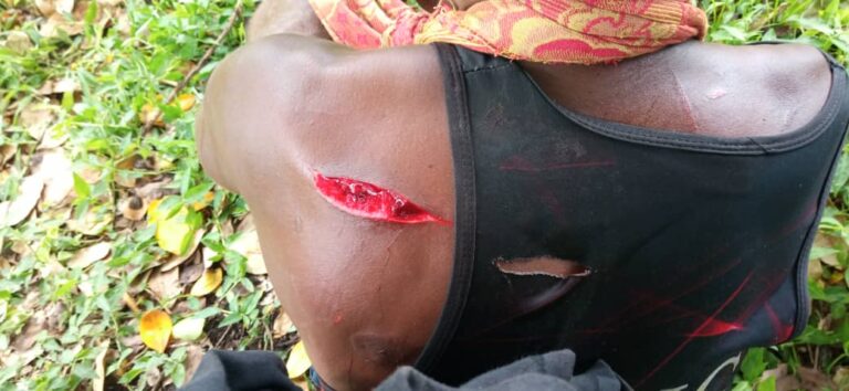 Rabaul town under siege after stabbing of youths