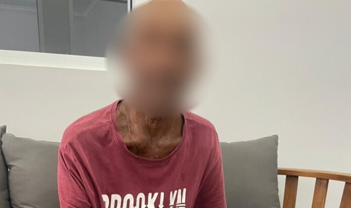 SARV victim visited PNG Tribal Foundation office today to help him on how an incident in Ihu can be be reported through Tribal Foundation’s assistance. He has developed a permanent disabled arm. Picture supplied.