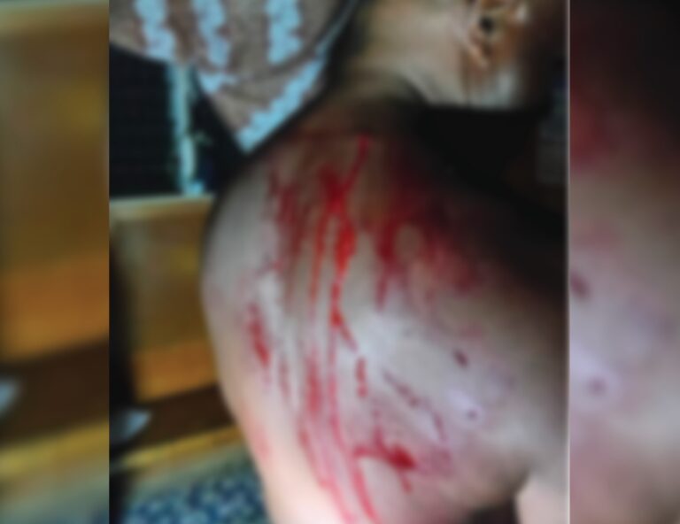 Tribal Foundation Demands Arrests After Attack on Rights Defender